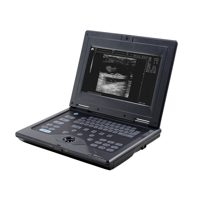 Full Digital Notebook Black and White Ultrasound Scanner B-2018