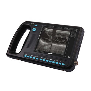 Full Digital Palm Size B/W Ultrasound Scanner BT-3000