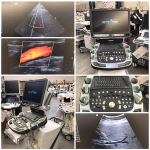 SIEMENS X700 vascular OB / GYN Ultrasound