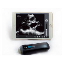 Veterinary  Wireless Ultrasound  Scanner Machine BSCAN-2