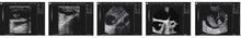 Full Digital Notebook B/W Ultrasound Scanner for Veterinary Use  B-2018V