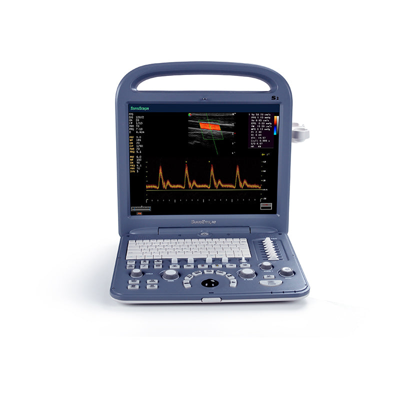 SONOSCAPE Color Doppler-S2 OB / GYN Ultrasound