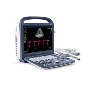 SONOSCAPE S2V Portable Color Doppler System OB / GYN Ultrasound