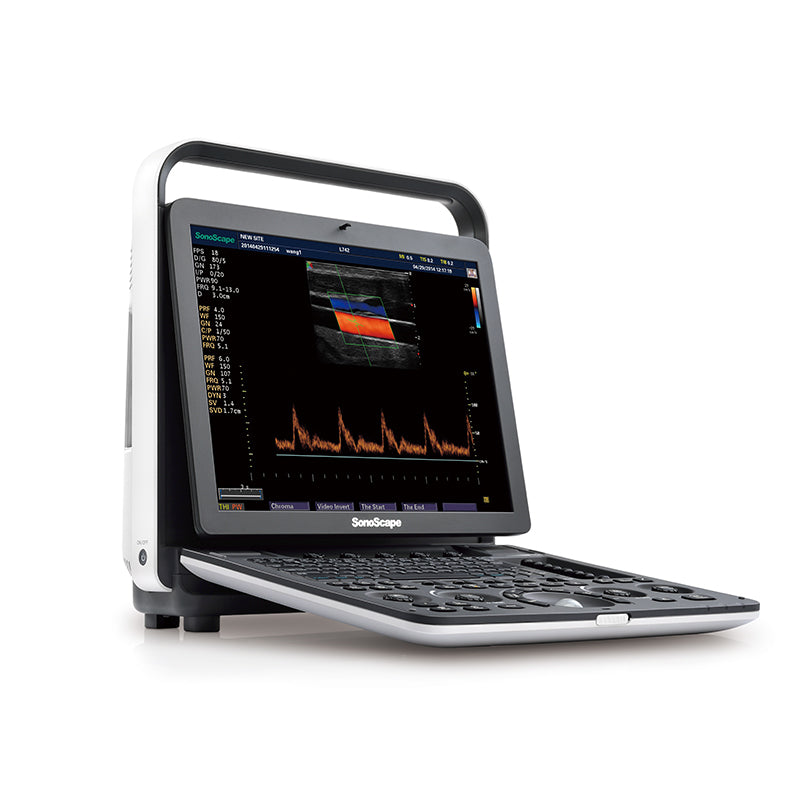 SONOSCAPE S9Pro Portable Color Doppler System OB / GYN Ultrasound