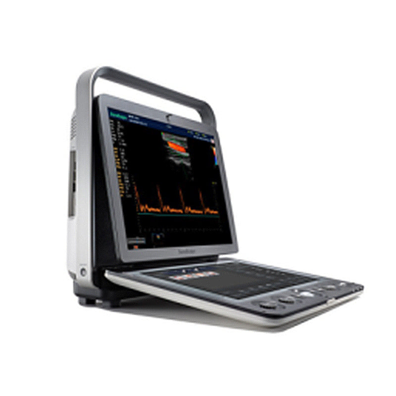 SONOSCAPE S9V Portable Color Doppler System OB / GYN Ultrasound