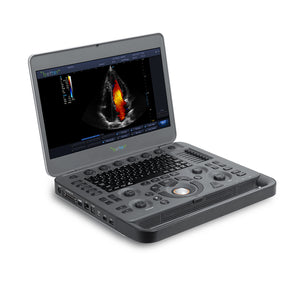 SONOSCAPE X5 Portable Color Doppler System OB / GYN Ultrasound