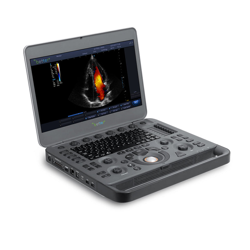 SONOSCAPE X3 OB / GYN Ultrasound